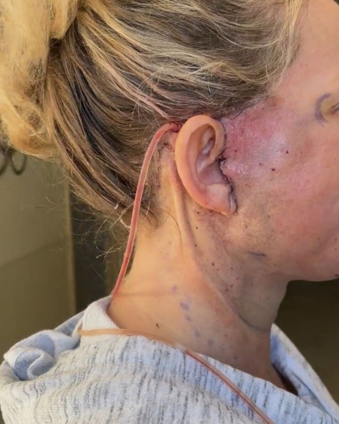 Image may contain Adult Person Skin Body Part Face Head and Neck